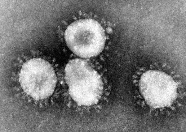 사스와 코로나19의 공통 병인인 코로나 바이러스를 전자 현미경으로 관측한 모습. 왕관 모양의 돌기체가 있어 코로나로 명명되었다. [사진=미 질병예방통제센터(CDC), 위키피디아]