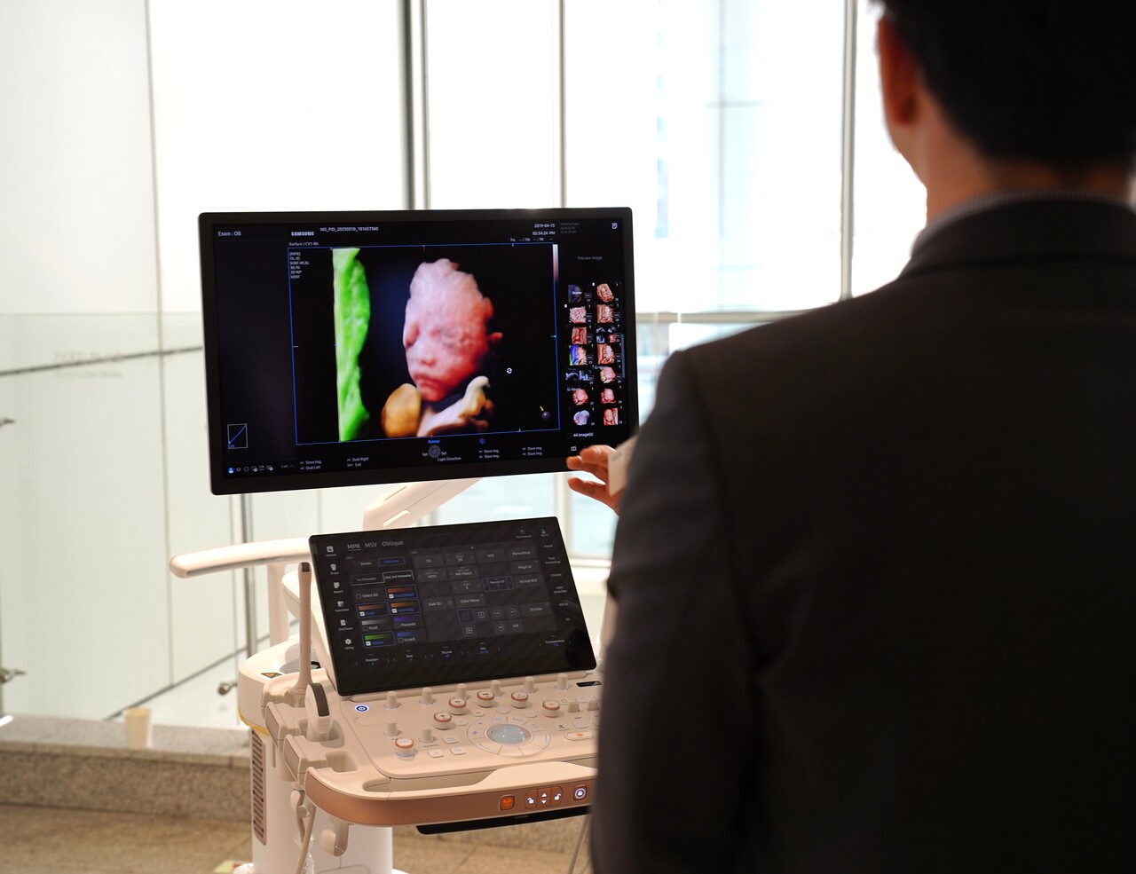 주주총회에 참석한 주주가 삼성메디슨 기기 설명을 듣고 있다. [사진=김민우 기자]