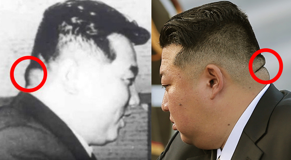 김정은(오른쪽) 북한 국무위원장과 할아버지인 김일성 국가주석. 김일성은 뒷목에 큰 혹이 불거져 어려움을 겪었다. [사진=뉴스핌]